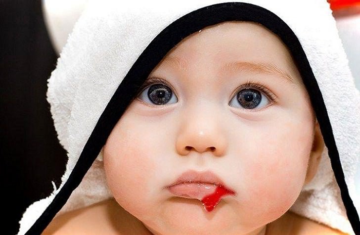 Плохая свертываемость крови у ребенка свидетельствует о наличии тромбоцитопении 