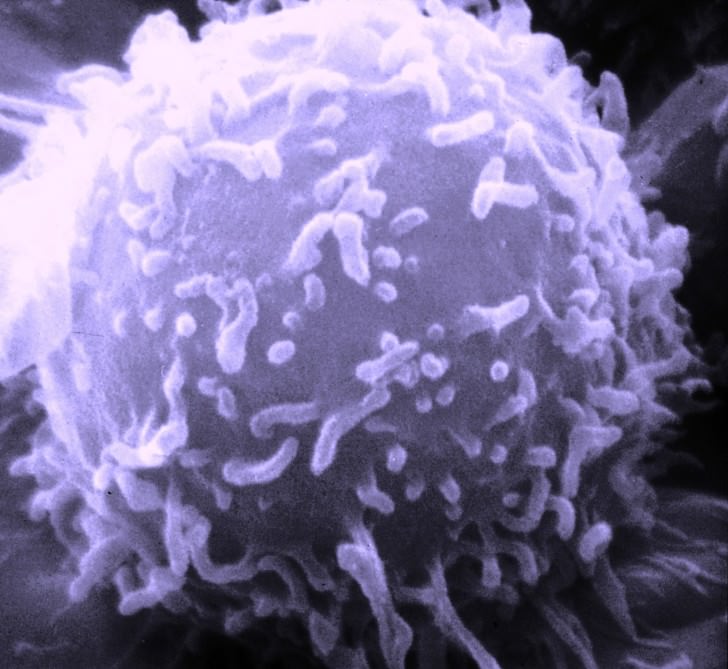 Клетка лимфоцита